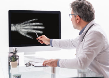 Radiografia de mãos e punhos: tudo sobre o exame de idade óssea